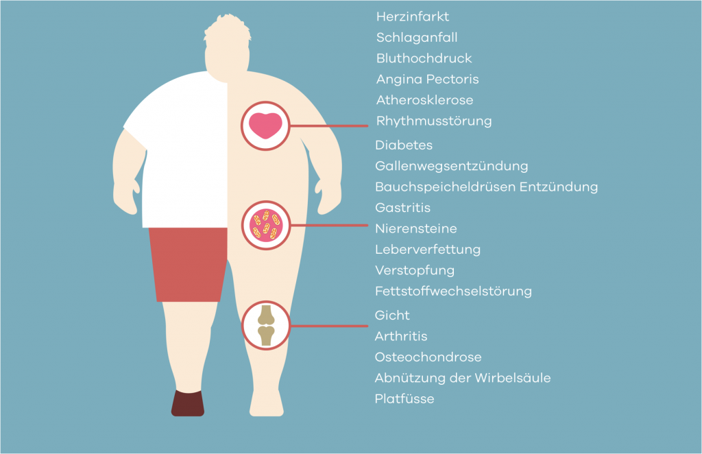 Übergewicht und hoher Blutdruck; Schematische Darstellungen der Auswirkungen des Übergewichts auf die Organsysteme