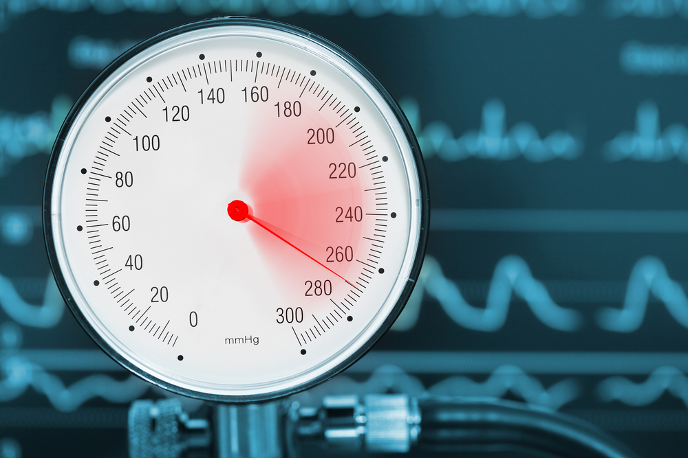 Plötzlich hoher Blutdruck (Blutdruckkrise) Der Blutdruck liegt oft über 200/120mmHg